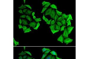 Immunofluorescence analysis of HeLa cells using C4BPB Polyclonal Antibody
