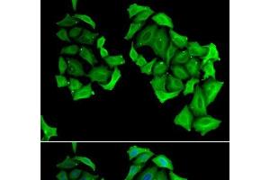 Immunofluorescence analysis of HeLa cells using C4BPB Polyclonal Antibody (C4BPB anticorps)