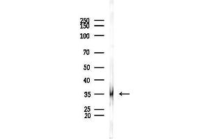 anti-Osteoclast Associated Receptor (OSCAR) antibody