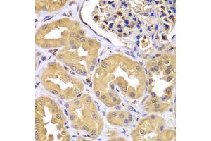 Immunohistochemistry of paraffin-embedded human kidney using LZTR1 antibody (ABIN5975506) at dilution of 1/100 (40x lens). (LZTR1 anticorps)