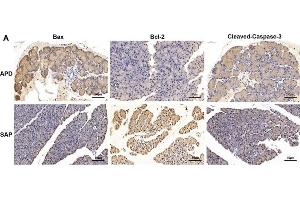 APD treatment enhances pancreatic acinar cell apoptosis in SAP rats.
