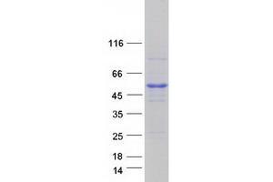Validation with Western Blot