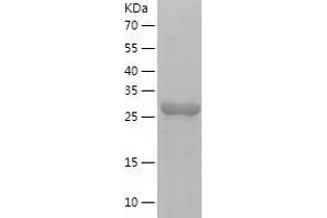Western Blotting (WB) image for Lactamase, beta 2 (LACTB2) (AA 1-288) protein (His-IF2DI Tag) (ABIN7123706)