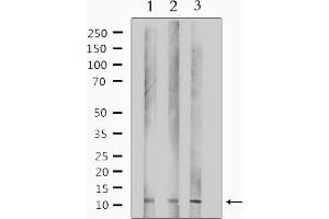 Western blot analysis of extracts from various samples, using TUSC2 Antibody. (TUSC2 anticorps  (Internal Region))