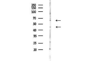 anti-serum/glucocorticoid Regulated Kinase 1 (SGK1) (pSer78) antibody