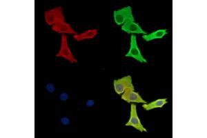 ABIN7095945 and ABIN7100007 staining Hela cells by IF/ICC.