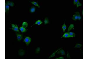 Immunofluorescence staining of MCF-7 cells with ABIN7175590 at 1:100, counter-stained with DAPI.