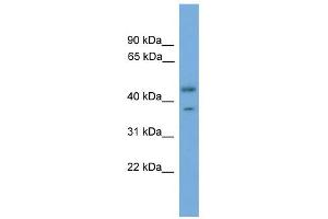 WB Suggested Anti-PRPSAP2 Antibody Titration: 0. (PRPSAP2 anticorps  (Middle Region))