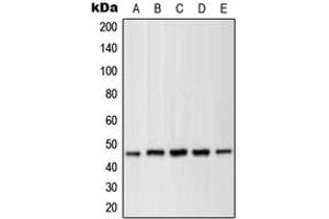 Western blot analysis of MKK1 (pT286) expression in HEK293T PMA-treated (A), NIH3T3 UV-treated (B), C2C12 (C), PC12 PMA-treated (D), C6 (E) whole cell lysates. (MEK1 anticorps  (pSer286))