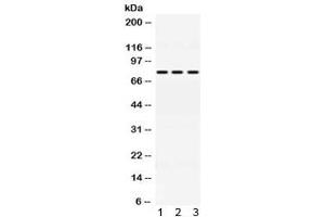 Western blot testing of 1) rat liver, 2) mouse HEPA and 3) A549 lysate with ACSL1 antibody at 0. (ACSL1 anticorps)
