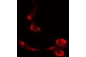 ABIN6277088 staining  Hela cells by IF/ICC. (Progesterone Receptor anticorps  (Internal Region))