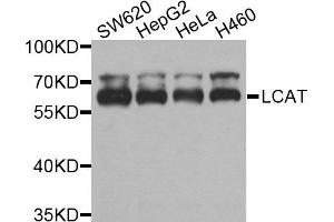 Western blot analysis of extracts of various cells, using LCAT antibody. (LCAT anticorps)