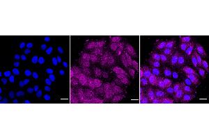 Immunocytochemical staining of HepG2 cells with caspase 8 antibody (ABIN7797907), 1:1,000). (Recombinant Caspase 8 anticorps)