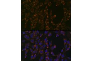 Immunofluorescence analysis of NIH-3T3 cells using CLPP Rabbit mAb (ABIN1682296, ABIN3017596, ABIN3017597 and ABIN7101508) at dilution of 1:100 (40x lens).
