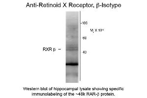 Western blot of Anti-Retinoid X Receptor beta (Mouse) Antibody - 200-301-E27 Western Blot of Mouse anti-Retinoid X Receptor beta antibody. (Retinoid X Receptor beta anticorps)
