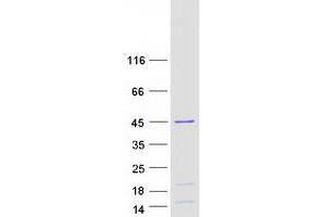Validation with Western Blot