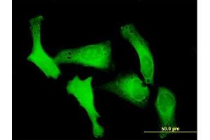 Immunofluorescence of purified MaxPab antibody to RANBP5 on HeLa cell.