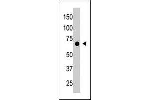 The CRY1 polyclonal antibody  is used in Western blot to detect CRY1 in placenta tissue lysate.