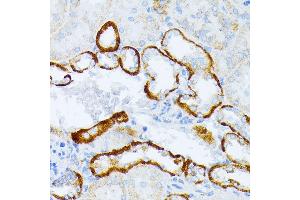Immunohistochemistry of paraffin-embedded mouse kidney using IL3RA antibody (ABIN1680453, ABIN3018298, ABIN3018299, ABIN5664529 and ABIN6220429) at dilution of 1:100 (40x lens).