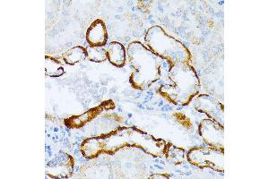 Immunohistochemistry of paraffin-embedded mouse kidney using IL3RA antibody (ABIN1680453, ABIN3018298, ABIN3018299, ABIN5664529 and ABIN6220429) at dilution of 1:100 (40x lens). (IL3RA anticorps  (AA 1-100))
