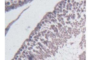 Detection of BCAT1 in Rat Testis Tissue using Polyclonal Antibody to Branched Chain Aminotransferase 1, Cytosolic (BCAT1) (BCAT1 anticorps  (AA 179-411))