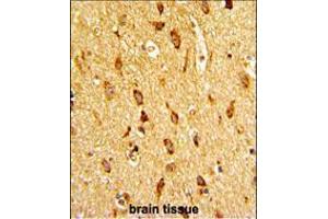 Formalin-fixed and paraffin-embedded human brain tissue with H Cadherin (CDH13) Antibody (N-term), which was peroxidase-conjugated to the secondary antibody, followed by DAB staining.