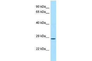 WB Suggested Anti-Cfdp1 Antibody Titration: 1.