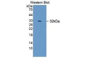 Detection of Recombinant SIRPa, Mouse using Polyclonal Antibody to Signal Regulatory Protein Alpha (SIRPa) (SIRPA anticorps  (AA 56-296))