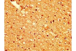 IHC image of ABIN7164465 diluted at 1:500 and staining in paraffin-embedded human brain tissue performed on a Leica BondTM system. (GPR158 anticorps  (AA 882-1003))