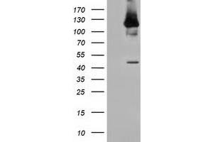 Western Blotting (WB) image for anti-Microtubule Associated Monoxygenase, Calponin and LIM Domain Containing 1 (MICAL1) antibody (ABIN1499466) (MICAL1 anticorps)