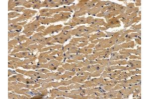 ABIN6263887 and ABIN6278613 at 1/100 staining rat heart tissue by IHC-P.