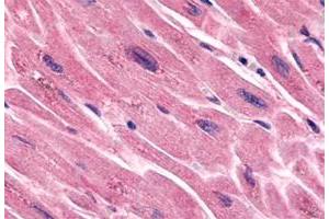 Immunohistochemistry (Formalin/PFA-fixed paraffin-embedded sections) of human heart tissue with FZD7 polyclonal antibody . (FZD7 anticorps  (N-Term))
