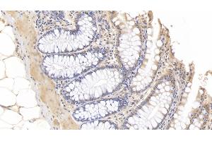 Detection of IL10 in Porcine Colon Tissue using Monoclonal Antibody to Interleukin 10 (IL10)