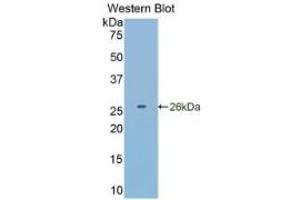 WB of Protein Standard: different control antibodies against Highly purified E.
