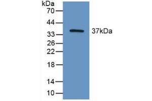 Western blot analysis of recombinant Mouse HIF2a. (EPAS1 anticorps  (AA 21-336))