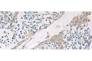 anti-Glucosidase, Beta, Acid (GBA) antibody