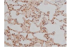 ABIN6267333 at 1/200 staining Rat lung tissue sections by IHC-P.