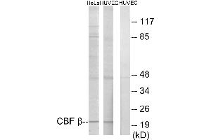 Immunohistochemistry analysis of paraffin-embedded human heart tissue using CBF β antibody. (CBFB anticorps)