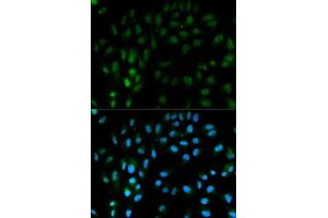 Immunofluorescence analysis of MCF-7 cells using TFPI antibody. (TFPI anticorps  (AA 29-224))