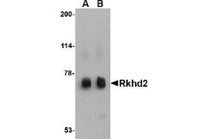 Western Blotting (WB) image for anti-Mex-3 Homolog C (C. Elegans) (MEX3C) (C-Term) antibody (ABIN1030621)