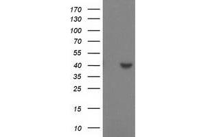 Western Blotting (WB) image for anti-Sulfotransferase Family, Cytosolic, 1C, Member 2 (SULT1C2) antibody (ABIN1501231) (SULT1C2 anticorps)