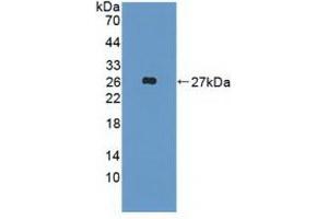 Detection of Recombinant FGF19, Human using Polyclonal Antibody to Fibroblast Growth Factor 19 (FGF19) (FGF19 anticorps  (AA 4-216))