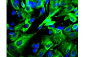 Immunofluorescent staining of SK-N-SH cells (Human neuroblastoma, ATCC HTB-11) (right). (AP2B1 anticorps  (AA 75-245))
