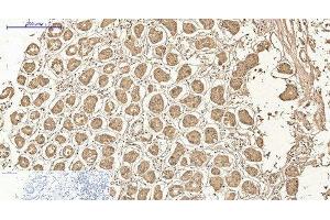 Immunohistochemistry of paraffin-embedded Human stomach tissue using AMACR Monoclonal Antibody at dilution of 1:200. (AMACR anticorps)