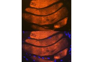 anti-Fast Skeletal Troponin I (TNNI2) antibody