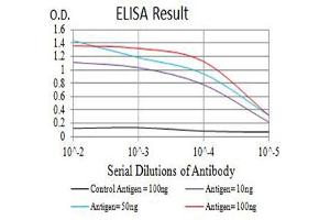 Black line: Control Antigen (100 ng),Purple line: Antigen (10 ng), Blue line: Antigen (50 ng), Red line:Antigen (100 ng)
