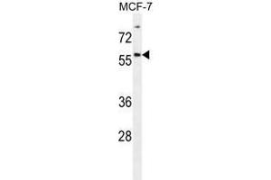 ZNF165 Antibody (Center) western blot analysis in MCF-7 cell line lysates (35 µg/lane). (ZNF165 anticorps  (Middle Region))