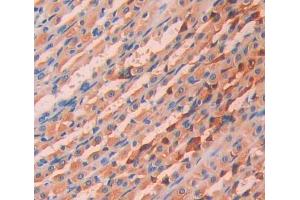 Used in DAB staining on fromalin fixed paraffin- embedded stomach tissue