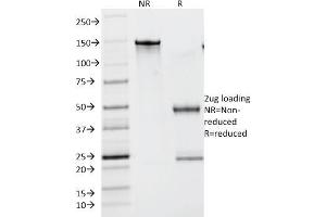 SDS-PAGE Analysis Purified Lambda Light Chain Monoclonal Antibody (N10/2). (IgL anticorps)