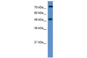 WB Suggested Anti-VDR AntibodyTitration: 1. (Vitamin D Receptor anticorps  (N-Term))